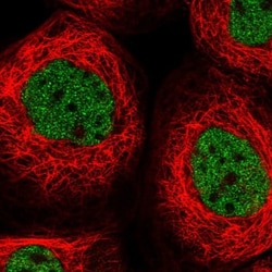 OTUD6B Antibody, Novus Biologicals 0.1mL; Unlabeled:Antibodies, Polyclonal